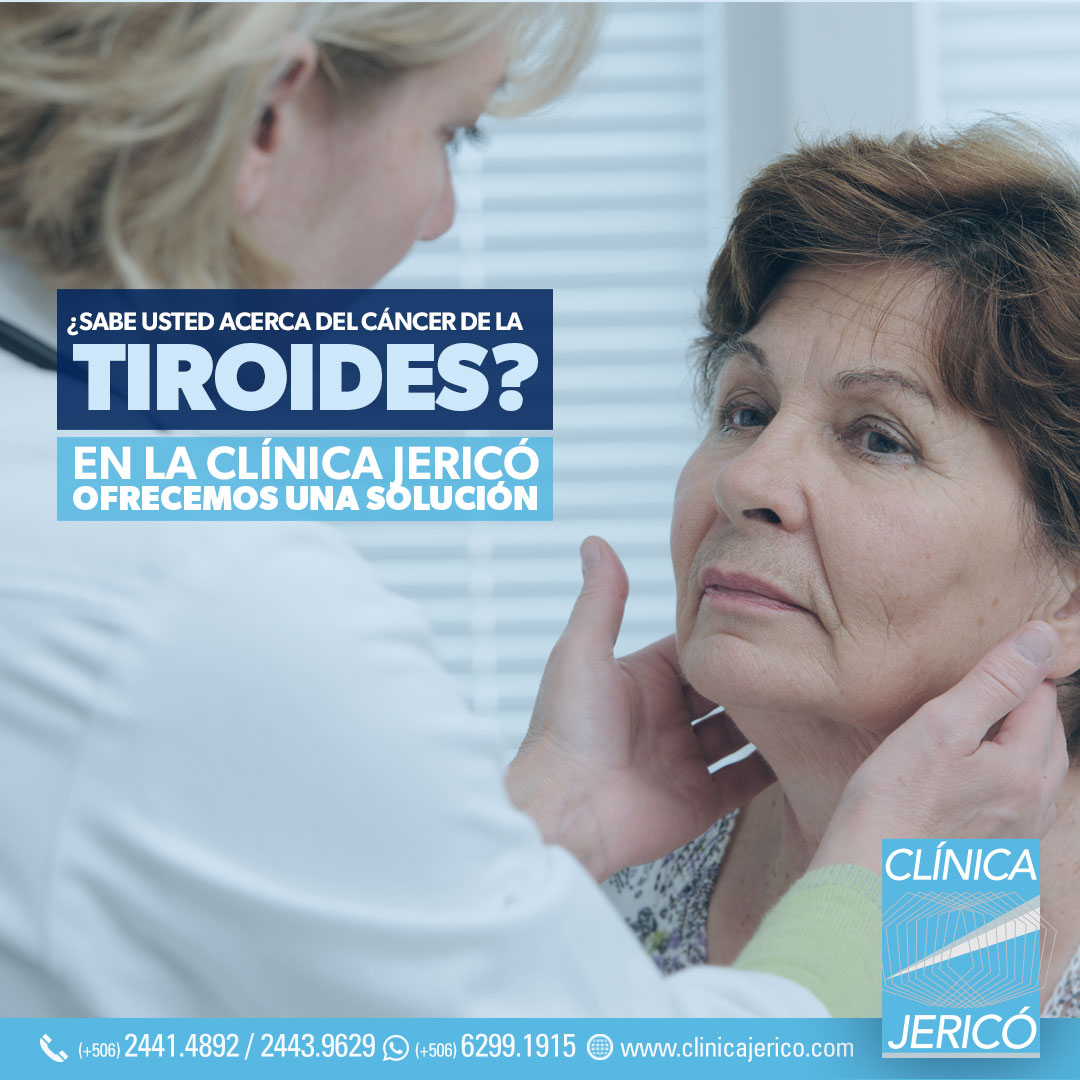 ¿Conoce usted sobre el cáncer en la glándula de la tiroides?