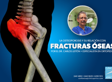 La Osteoporosis y su relación con fracturas óseas