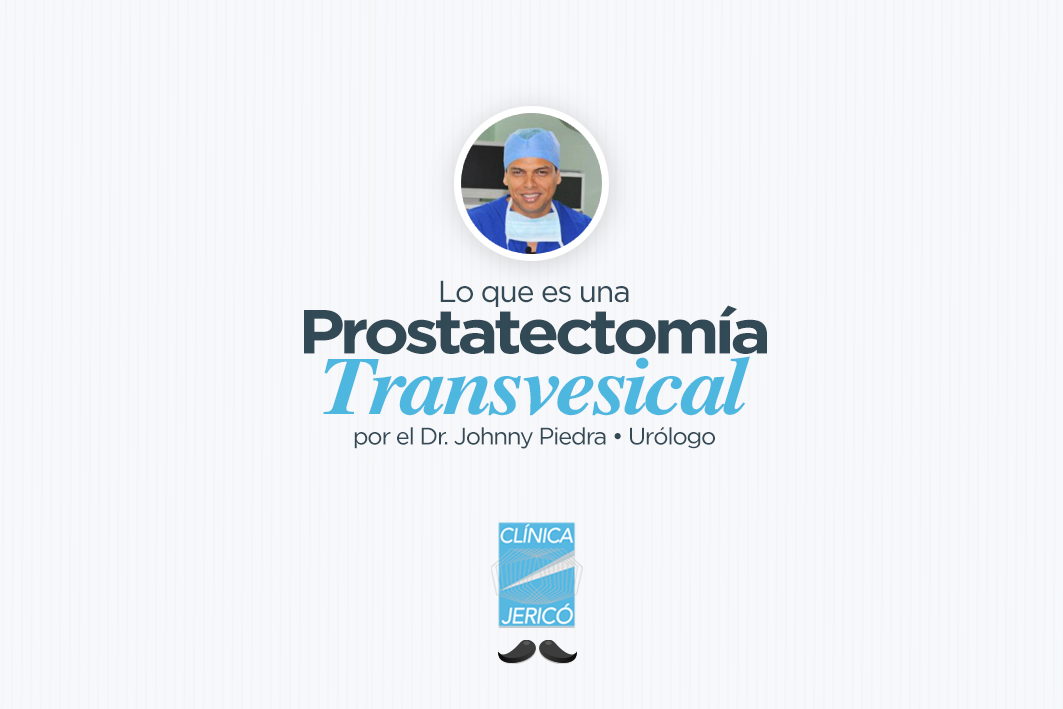 Prostatectomía Transvesical, ¿En qué consiste?.