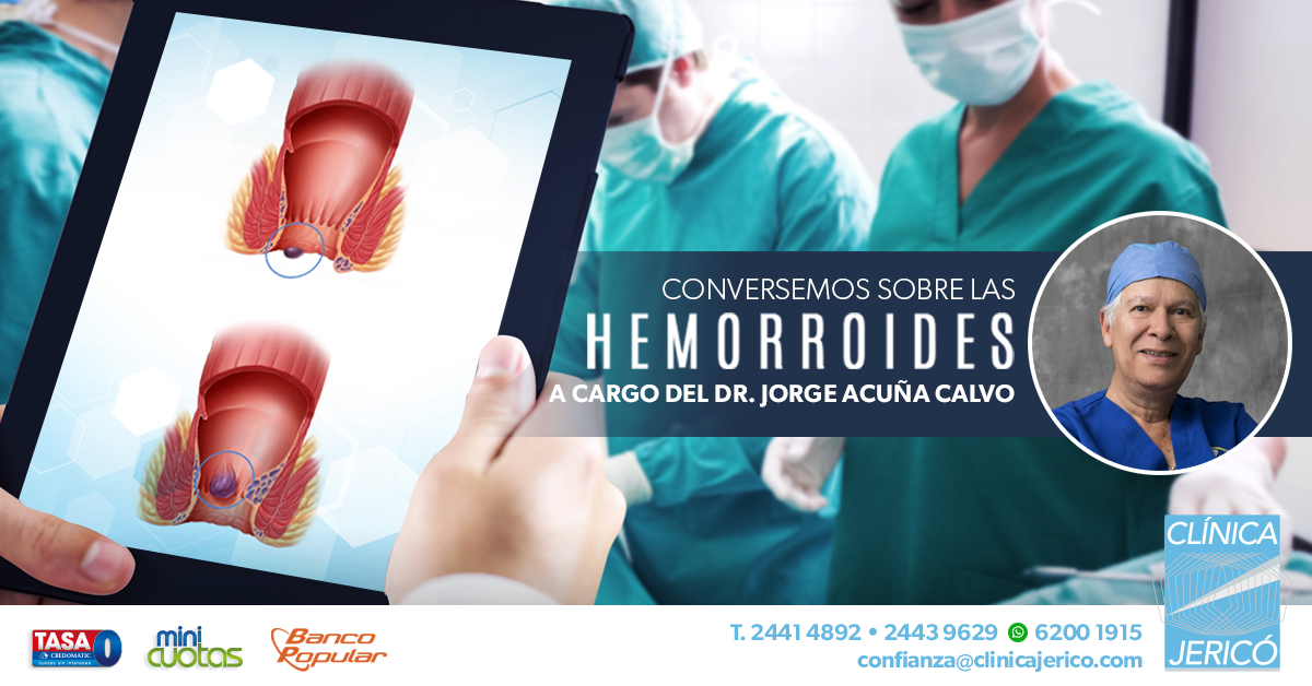 Hemorroides, diagnóstico y prevención